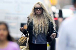 amanda bynes plastic surgery